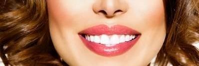 woman smiling after cosmetic dentistry in uptown charlotte nc