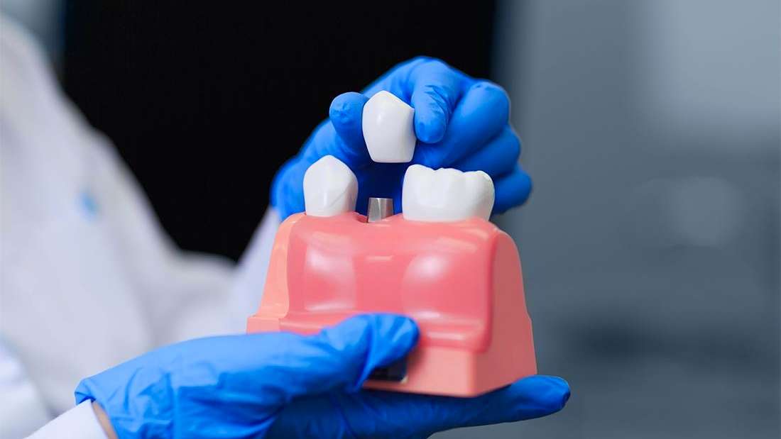 How to Reduce Risks Before, During, and After a Tooth Extraction