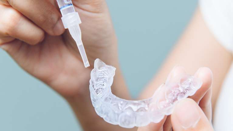 teeth whitening charlotte
