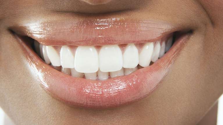 Cosmetic Dentistry