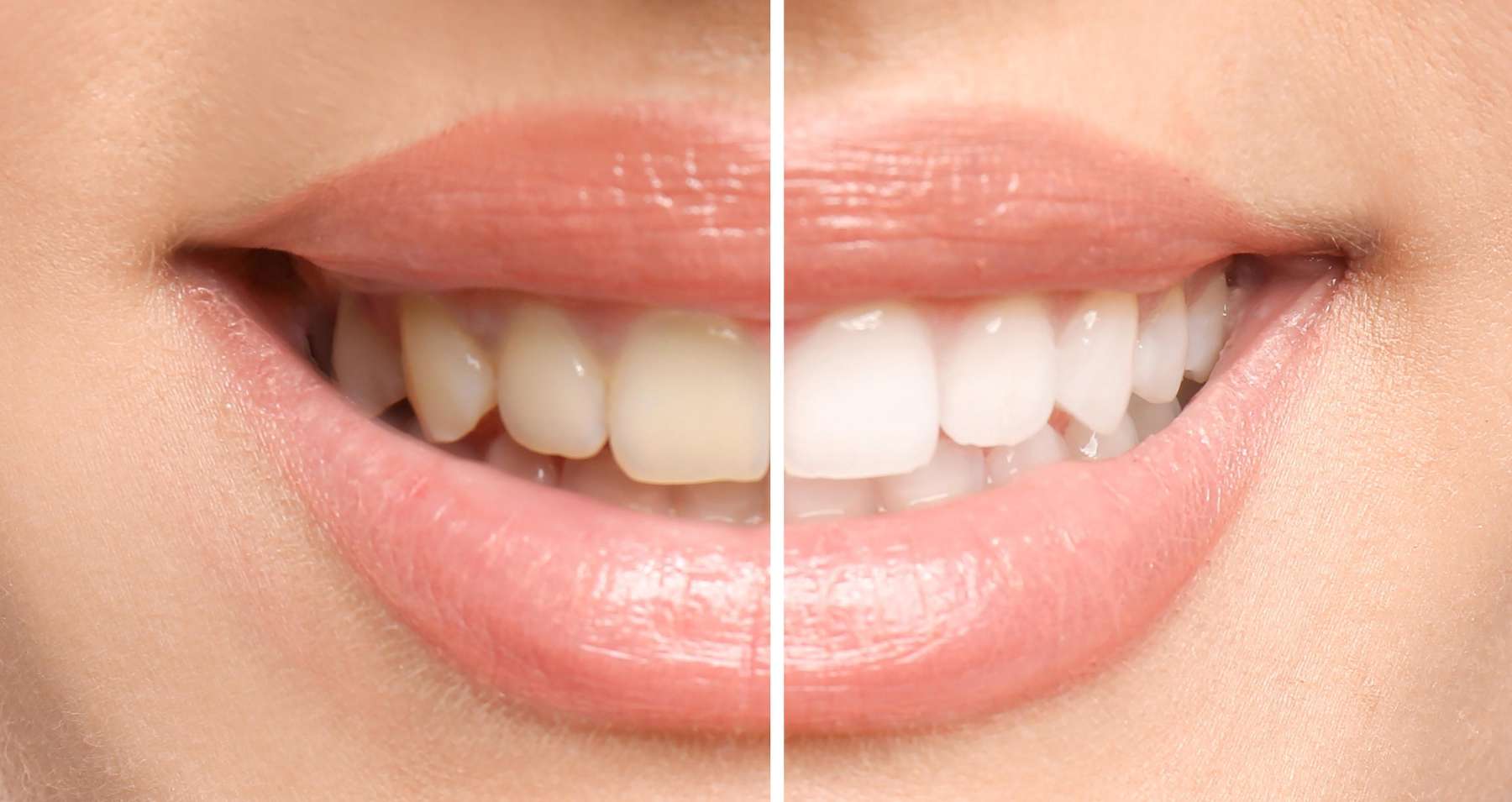 charlotte nc cosmetic dentist