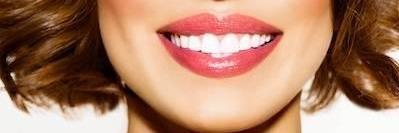 woman with dental implants in charlotte nc