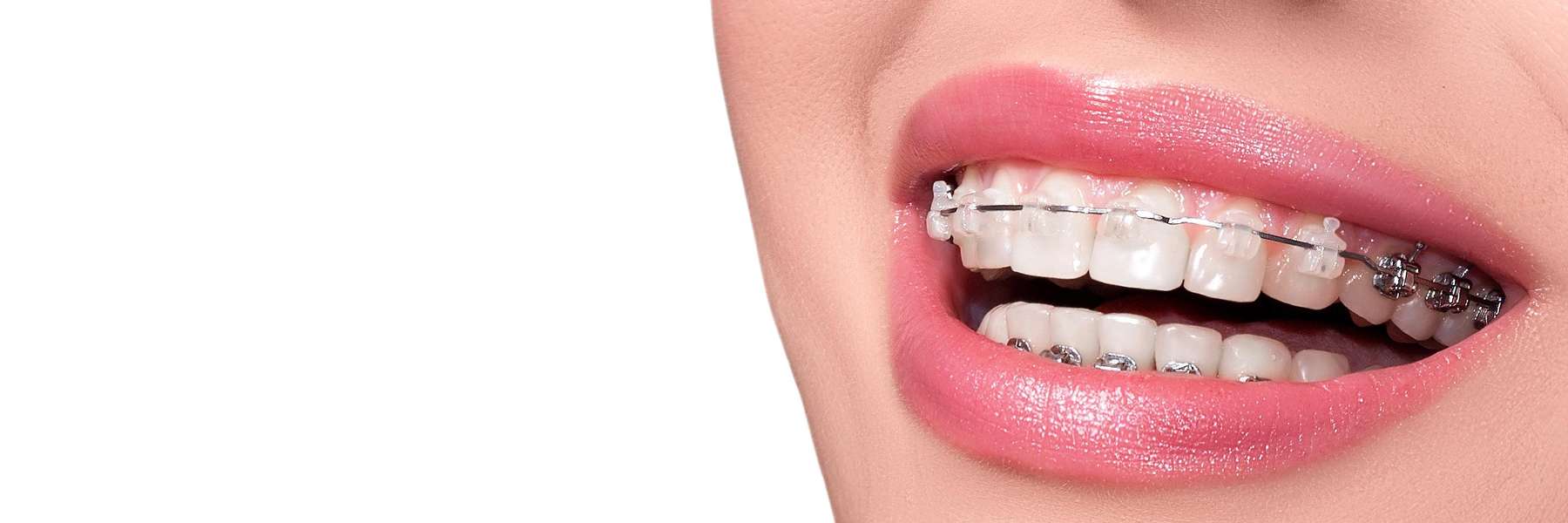 dentist charlotte nc