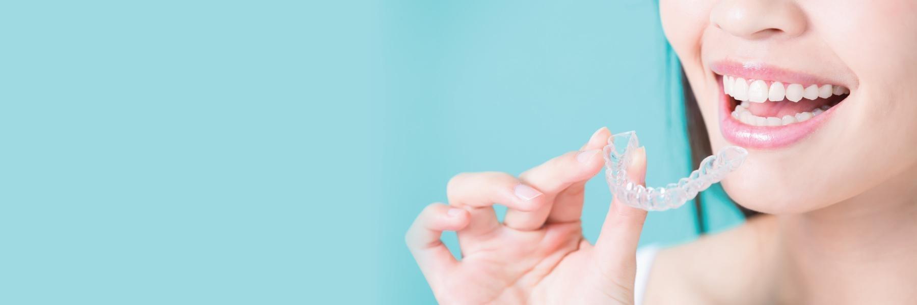 Invisalign dentist in charlotte nc